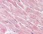 CASP1 / Caspase 1 Antibody (C-Terminus)